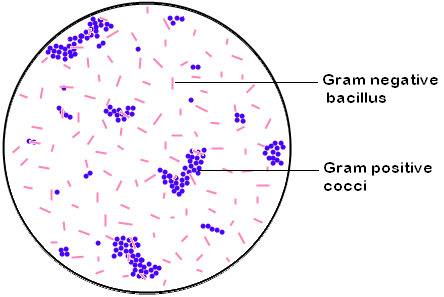 gram stain
